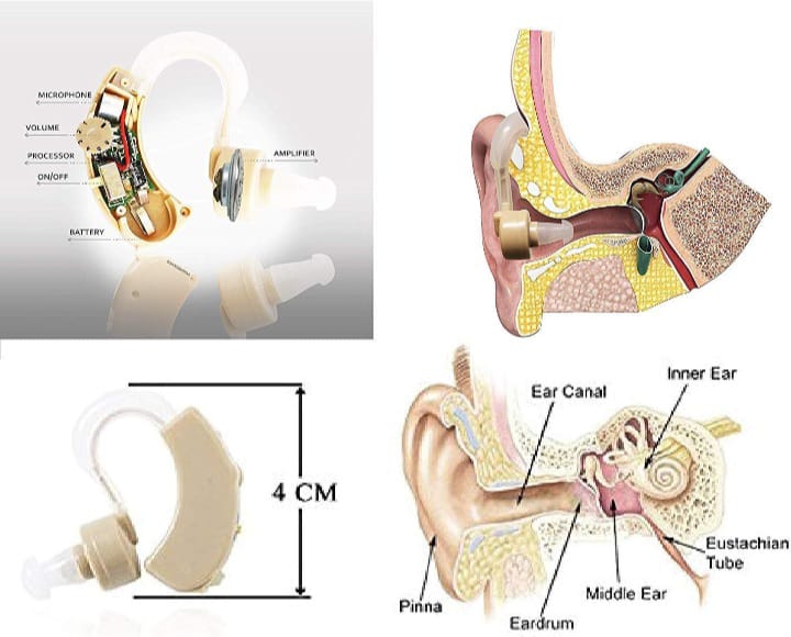 Sound Increaser for Ear @ Just 599/-